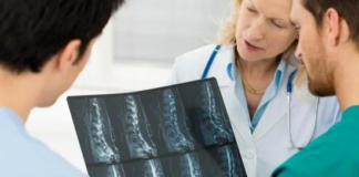 ¿Un tumor óseo siempre significa cáncer? Esto es lo que hay que saber