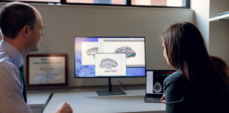 Un nuevo mapa del cerebro abre camino a tratamientos personalizados para la epilepsia